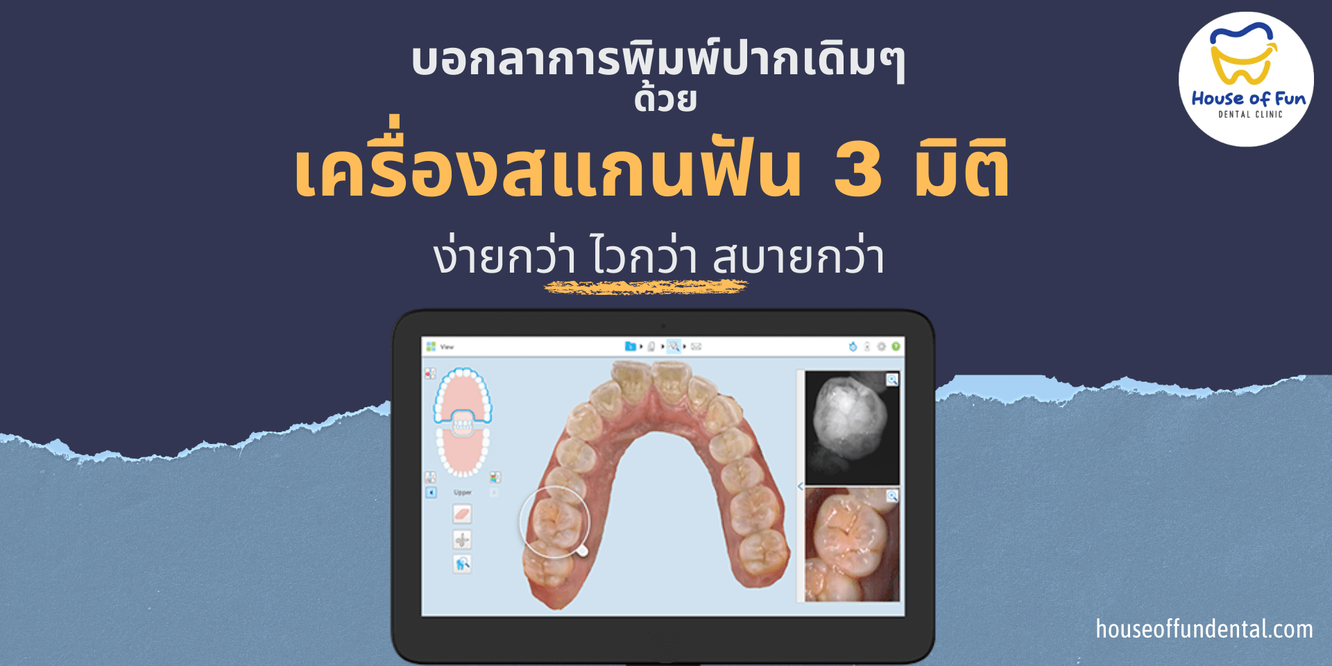 สแกนฟัน 3 มิติ ดีกว่าพิมพ์ปากแบบเดิมอย่างไร ที่ House of Fun Dental Clinic