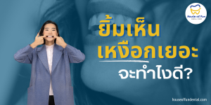 ยิ้มเห็นเหงือกเยอะ แก้ยังไงดี