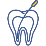 รักษารากฟัน House of Fun Dental Clinic พิษณุโลก