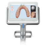iTero Scanner สำหรับจำลองผลลัพธ์ก่อนเริ่มจัดฟันใส